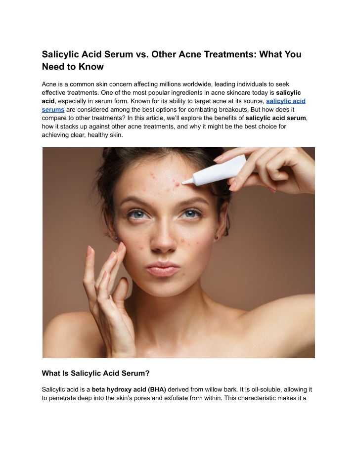 salicylic acid serum vs other acne treatments