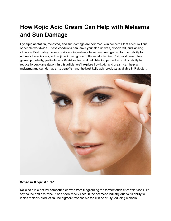 how kojic acid cream can help with melasma