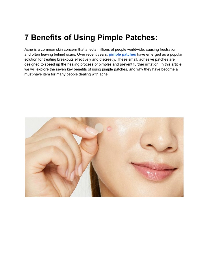 7 benefits of using pimple patches