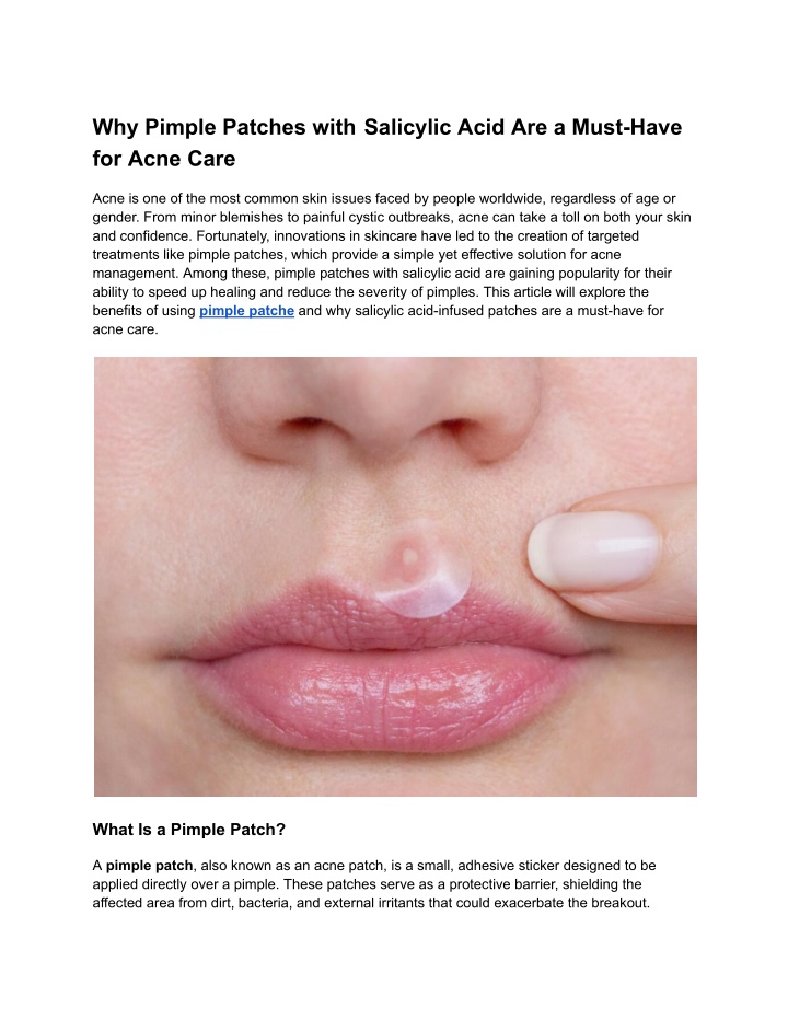 why pimple patches with salicylic acid are a must