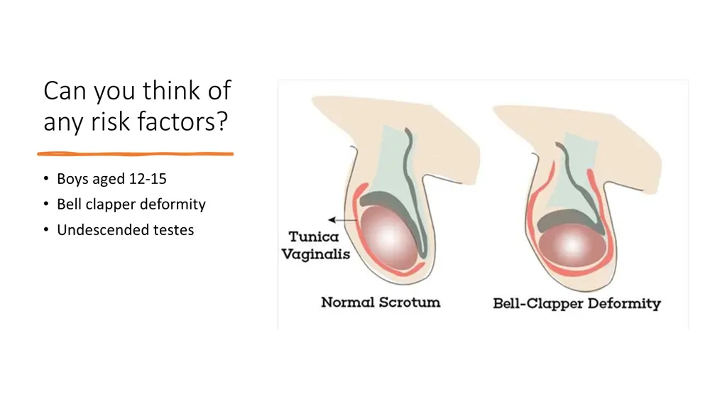 can you think of any risk factors