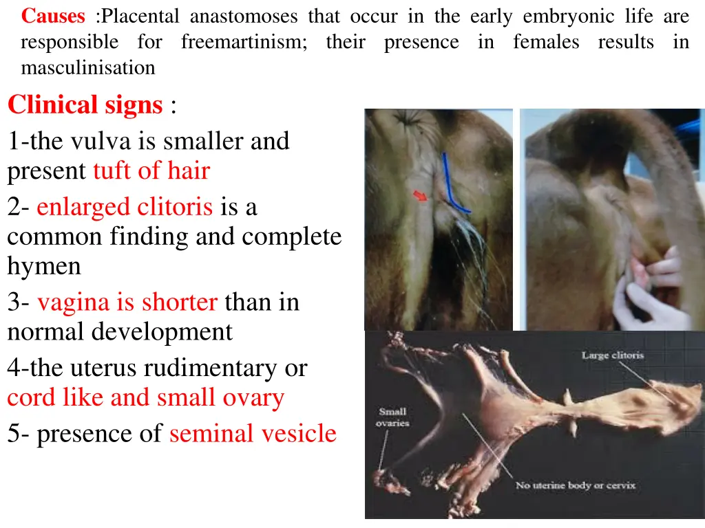 causes placental anastomoses that occur