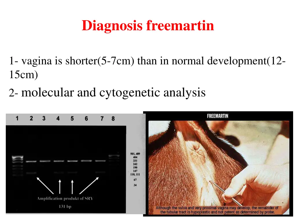 diagnosis freemartin