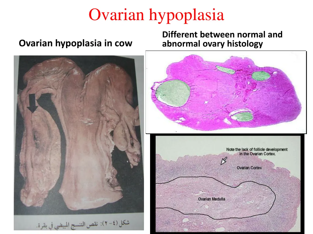 ovarian hypoplasia