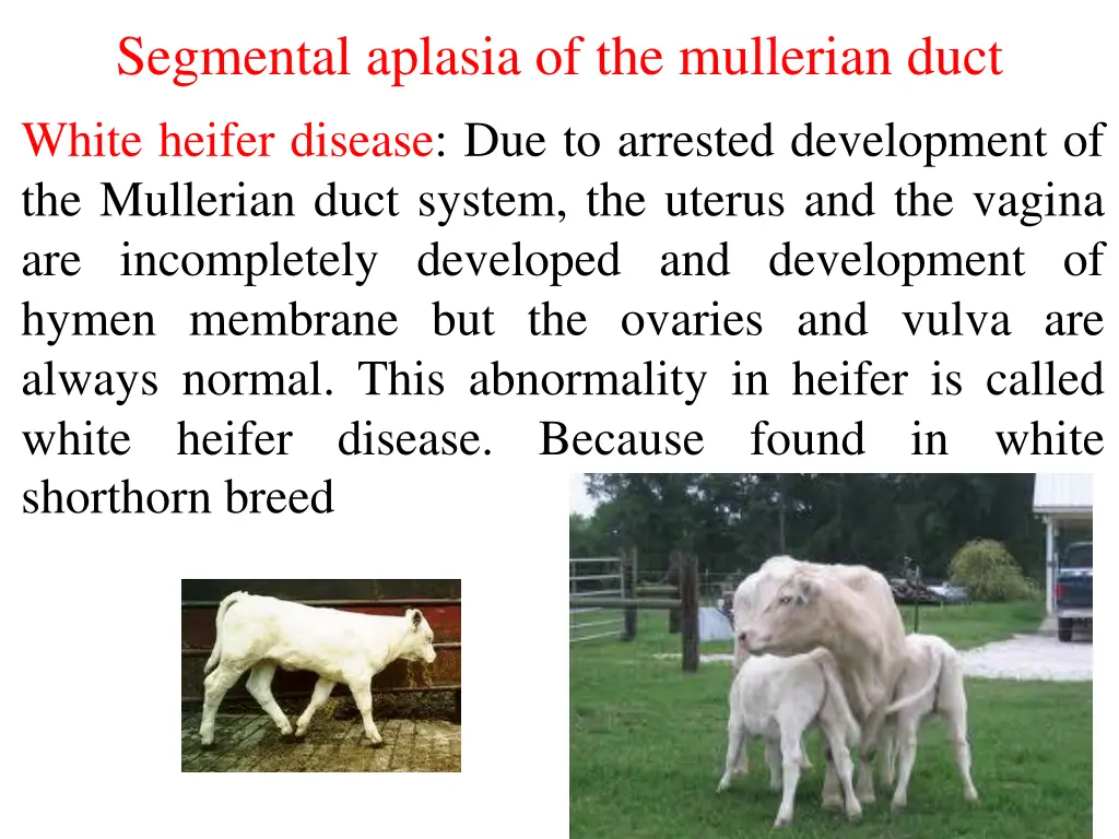 segmental aplasia of the mullerian duct white