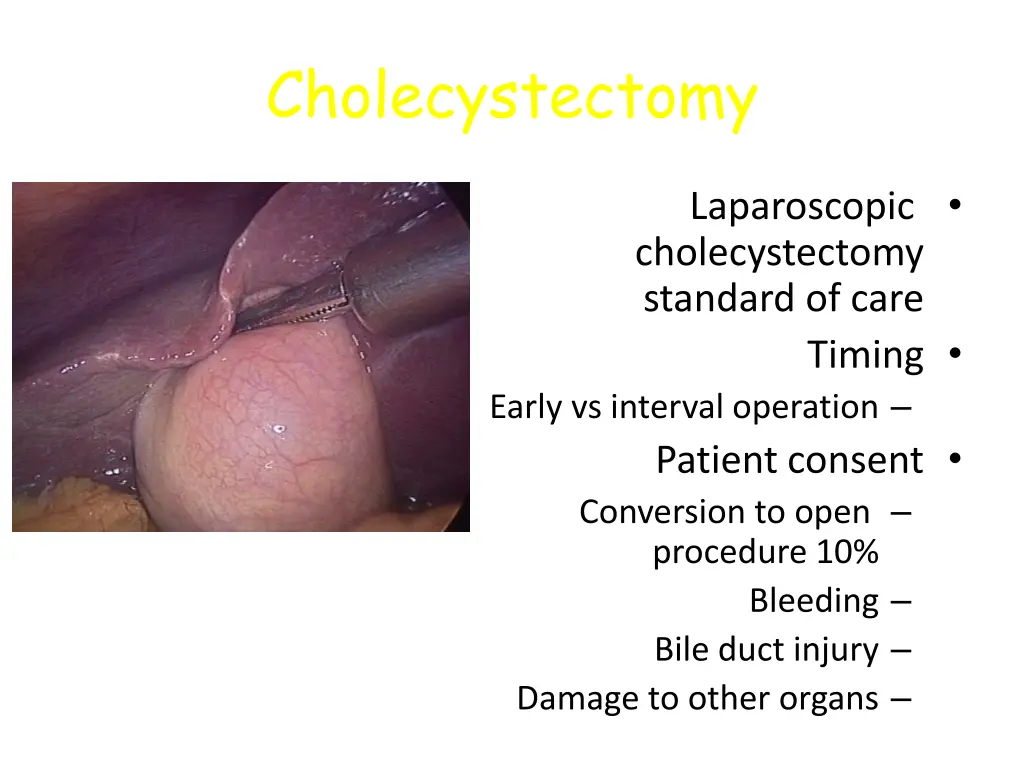 cholecystectomy