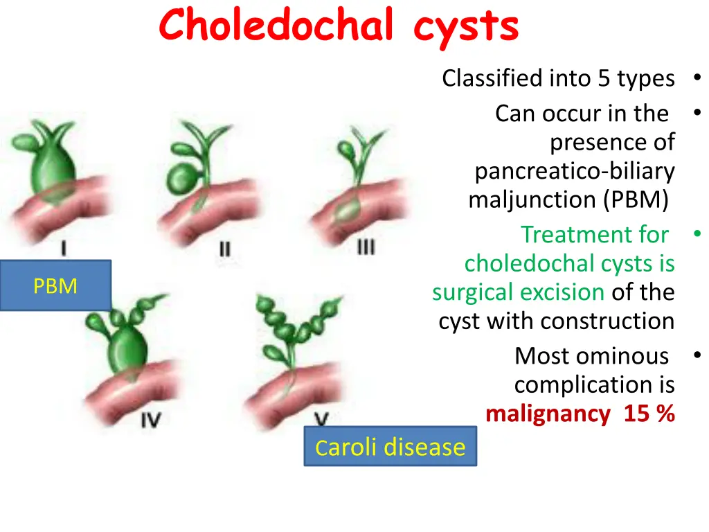 choledochal cysts