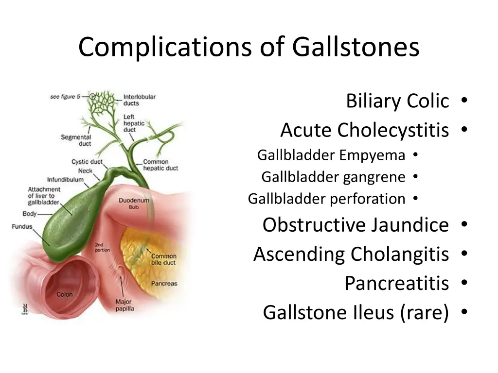 complications of gallstones