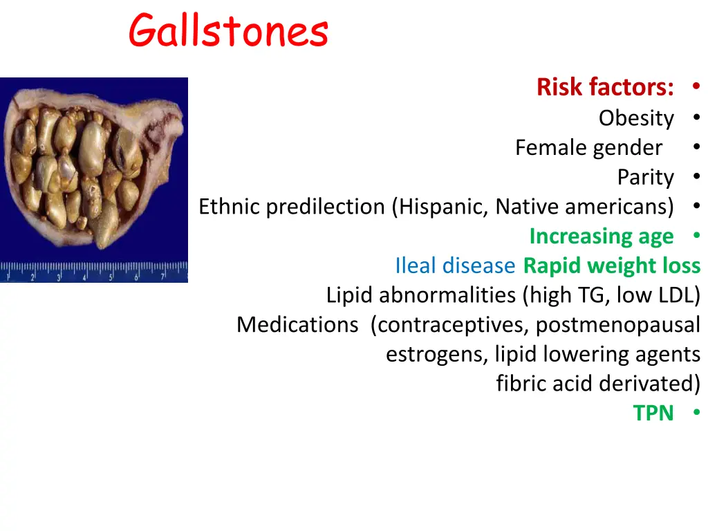 gallstones