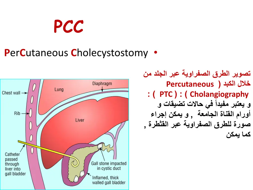 slide11