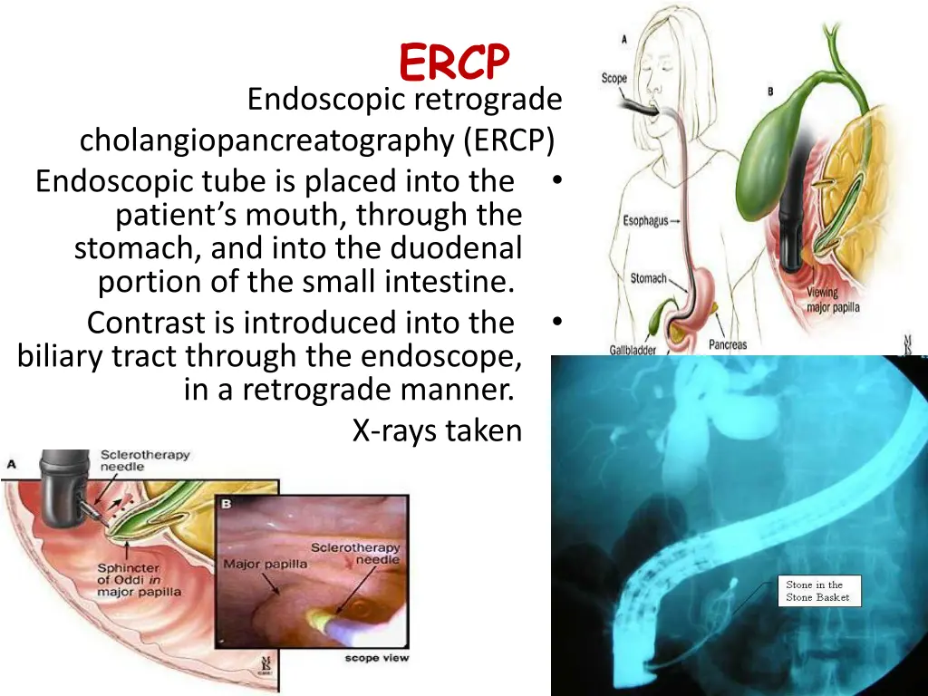 slide7