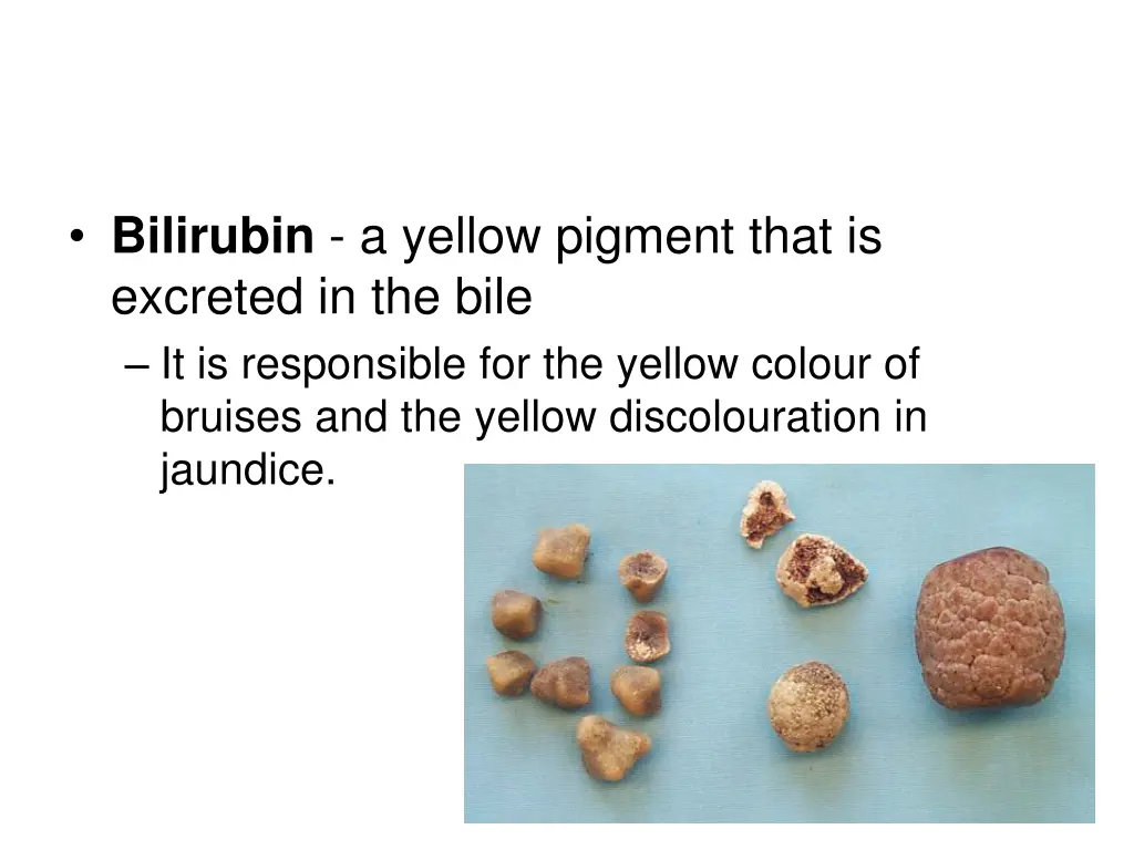 bilirubin a yellow pigment that is excreted