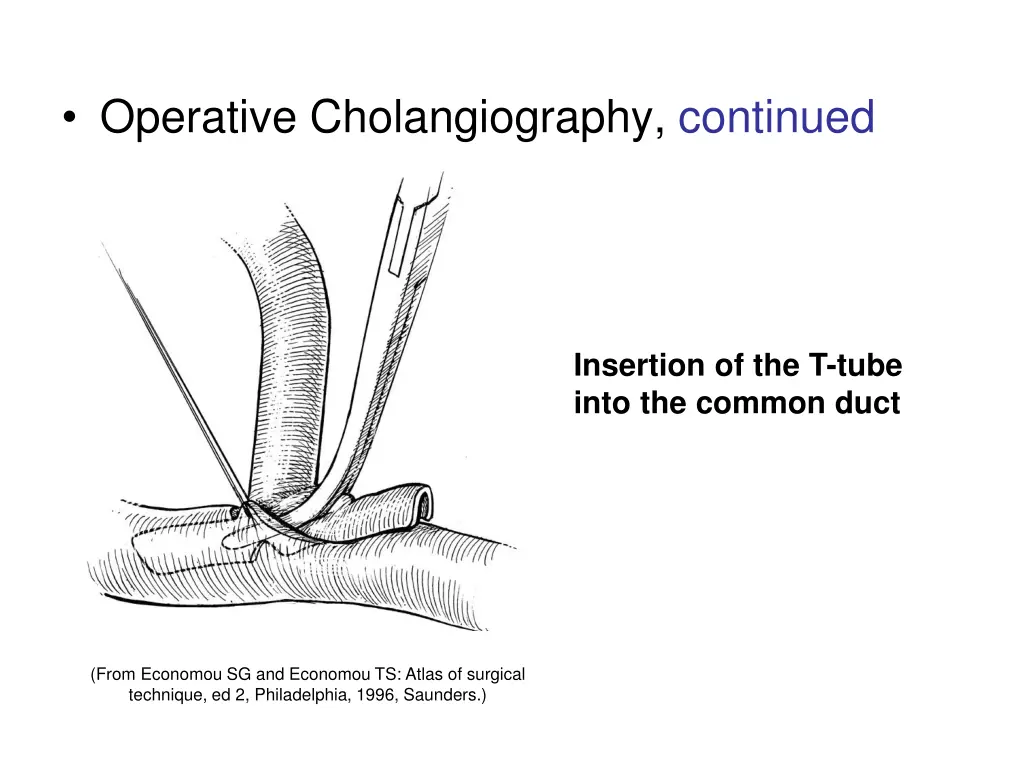 operative cholangiography continued