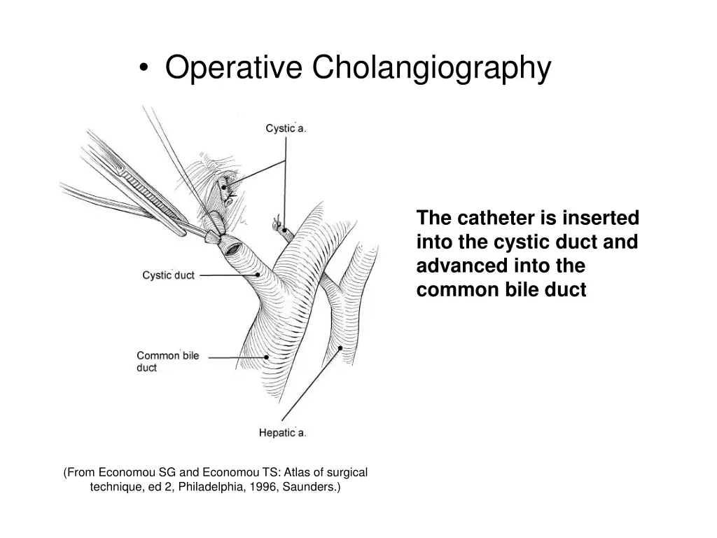 operative cholangiography