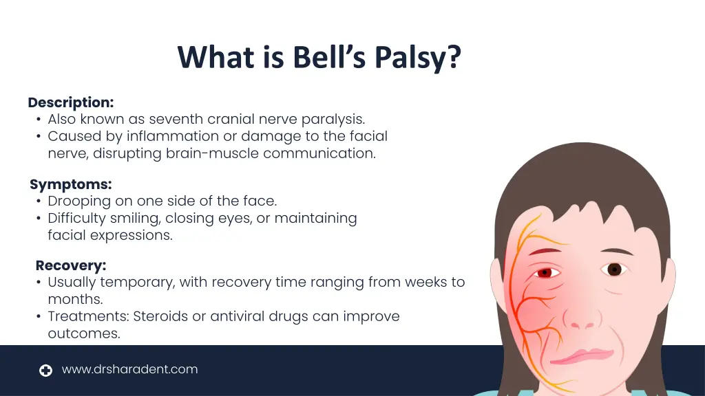 what is bell s palsy