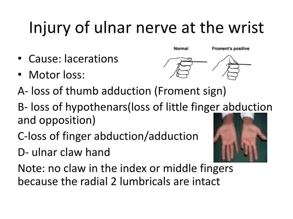 injury of ulnar nerve at the wrist