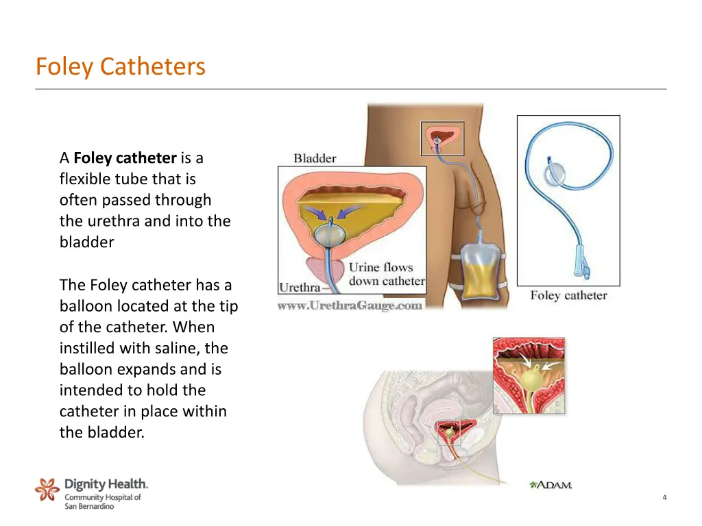 foley catheters