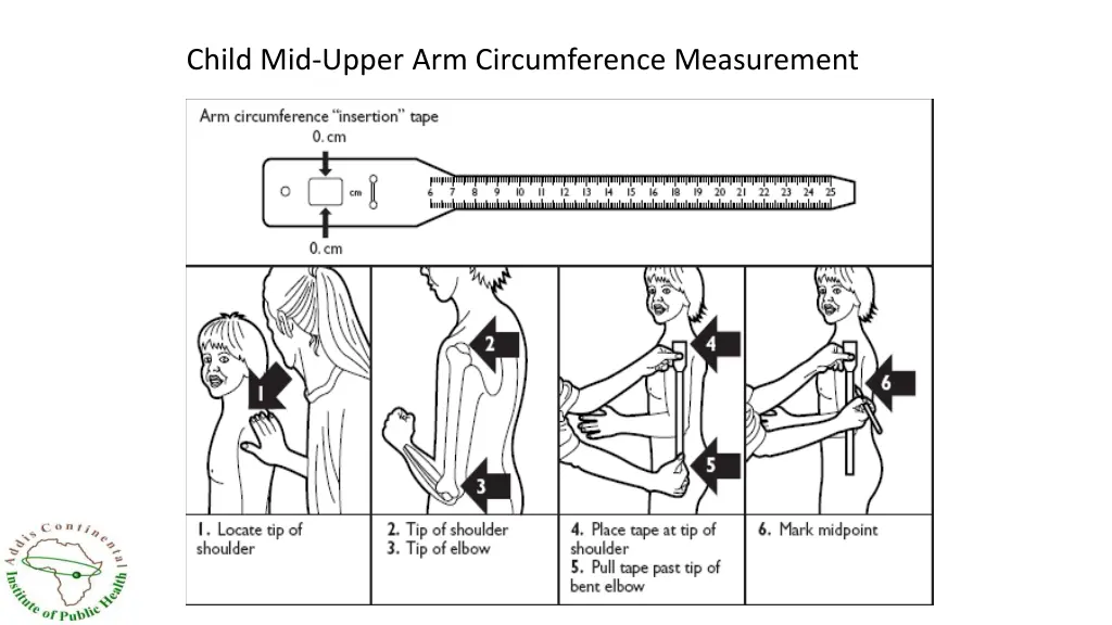 child mid upper arm circumference measurement