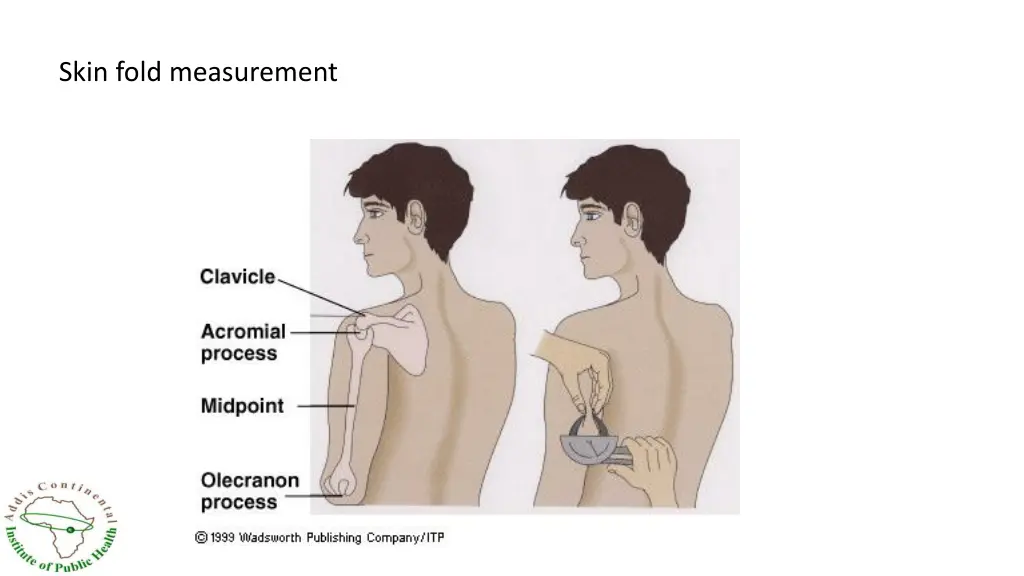 skin fold measurement