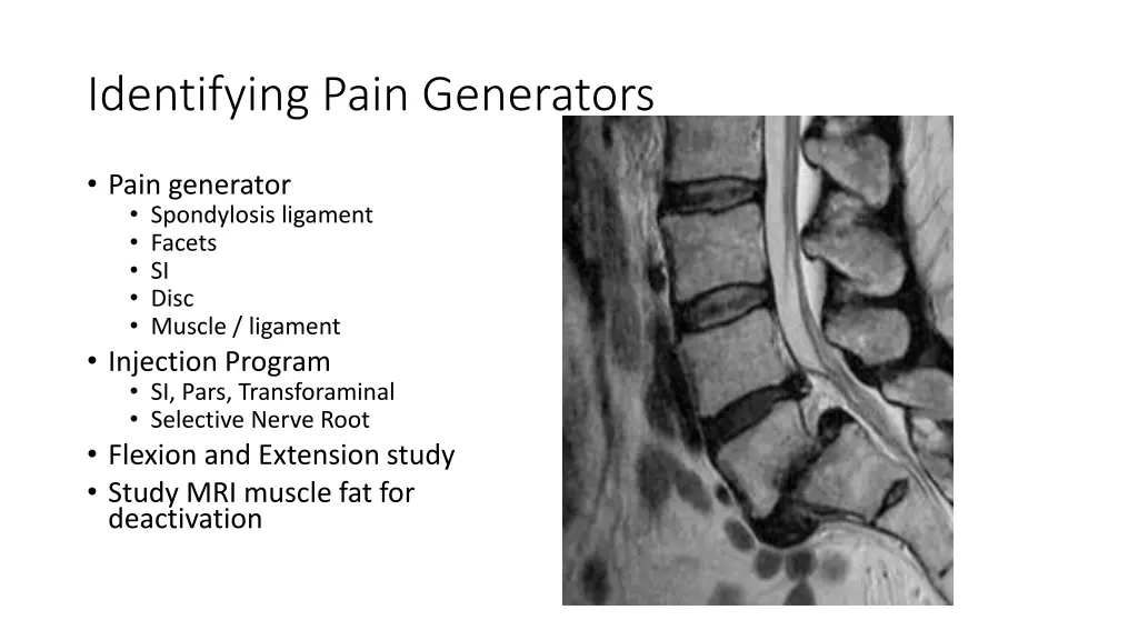 identifying pain generators