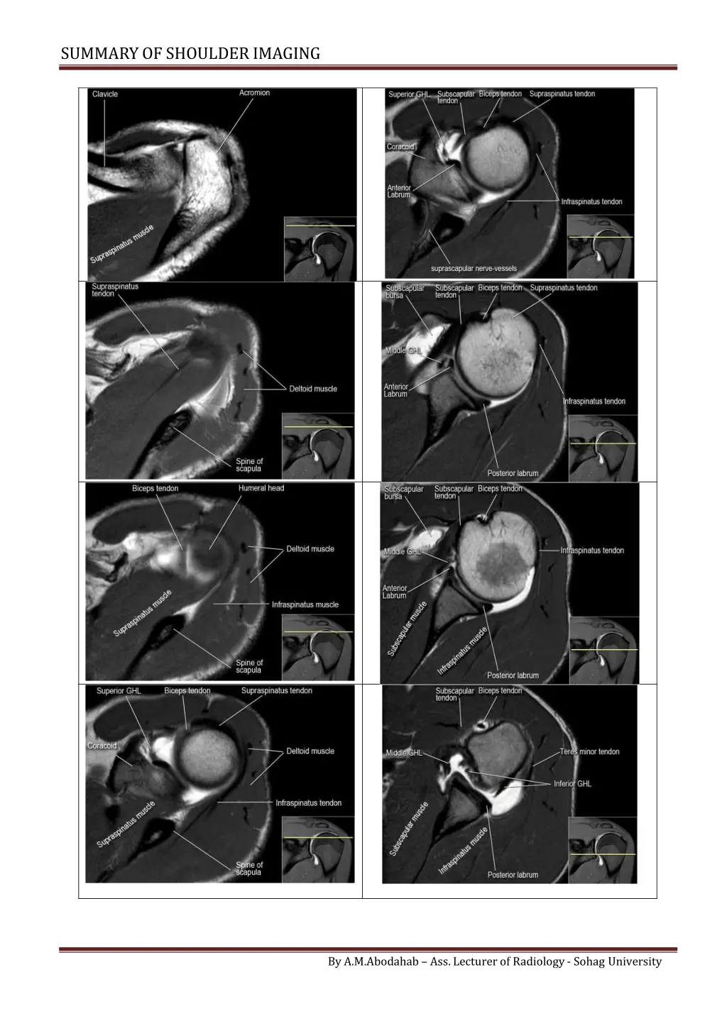 summary of shoulderimaging 4