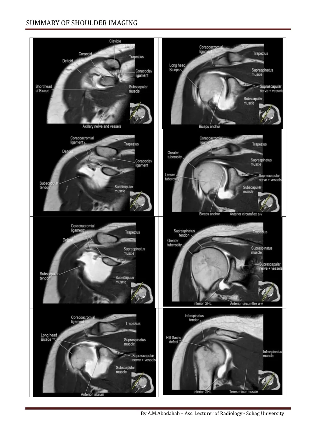 summary of shoulderimaging 5