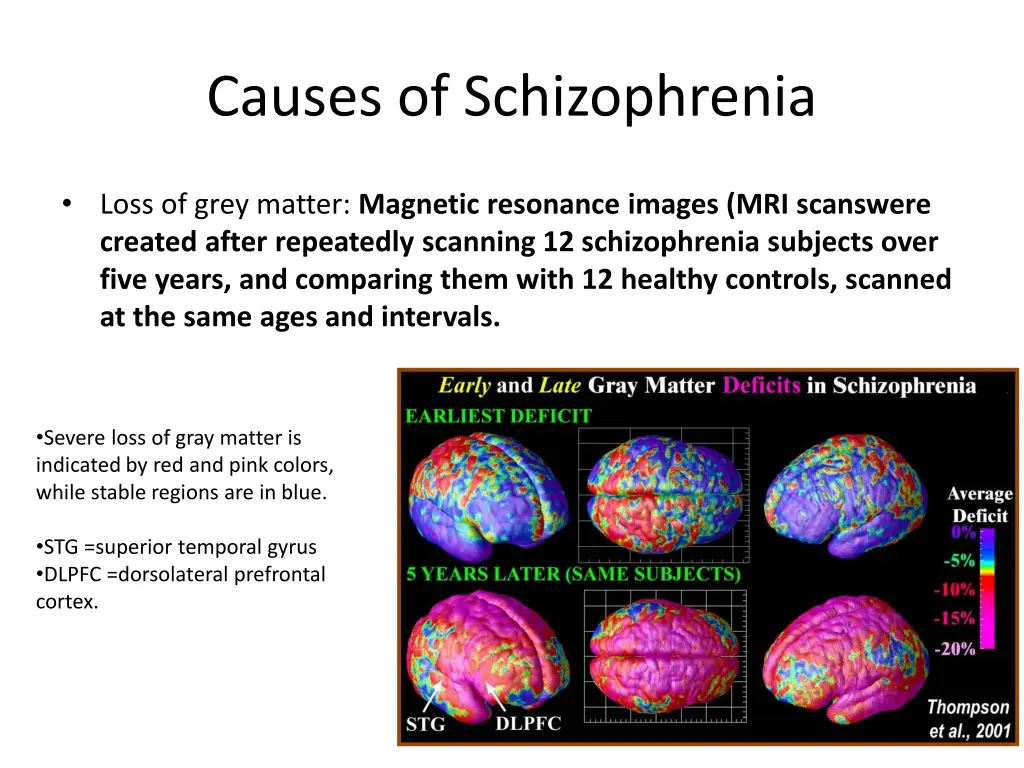 causes of schizophrenia 1