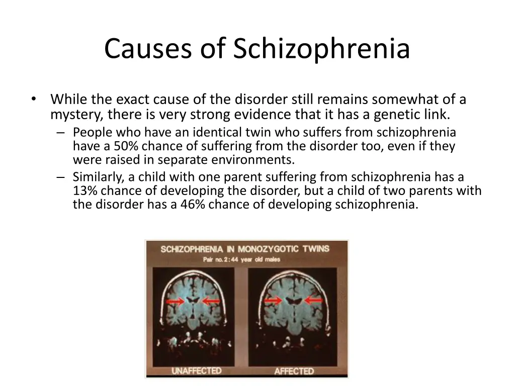 causes of schizophrenia 2