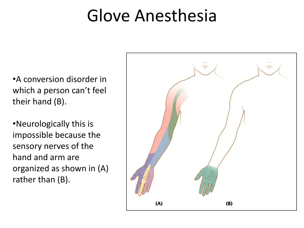 glove anesthesia