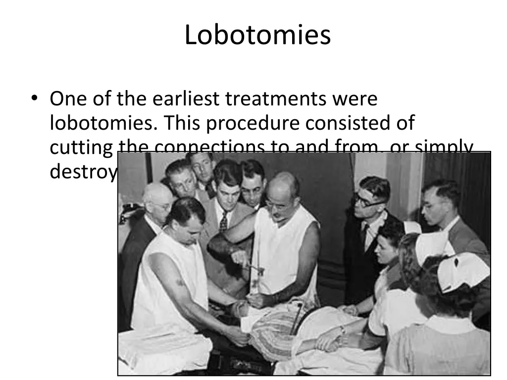 lobotomies