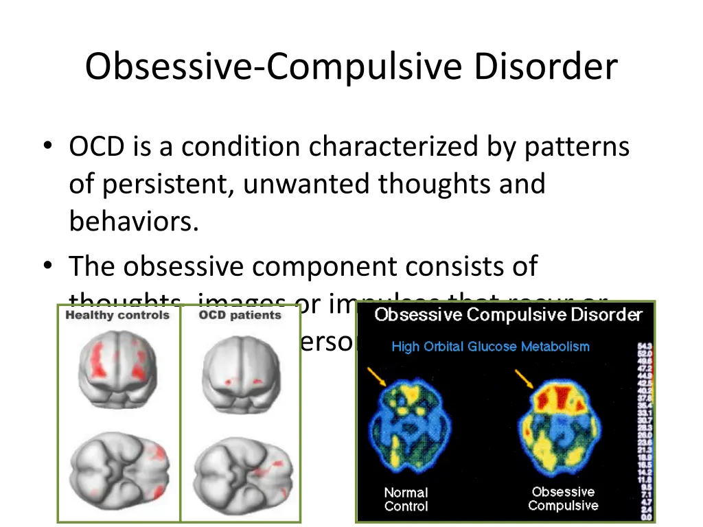 obsessive compulsive disorder