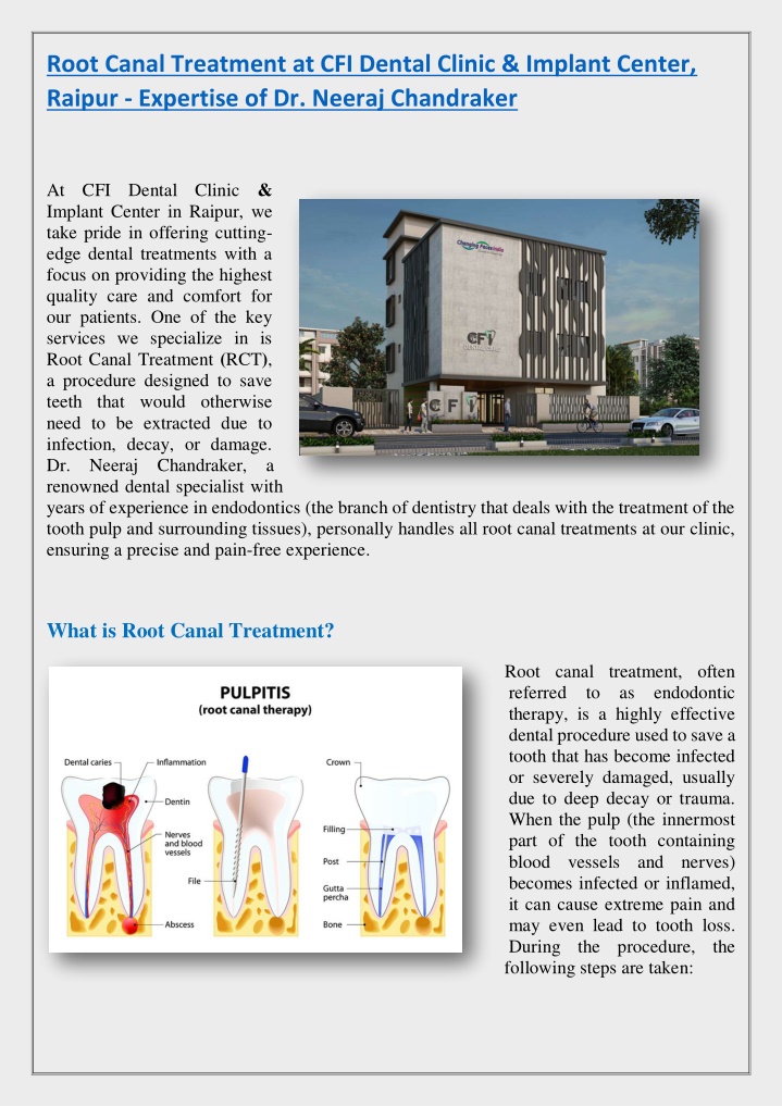 root canal treatment at cfi dental clinic implant