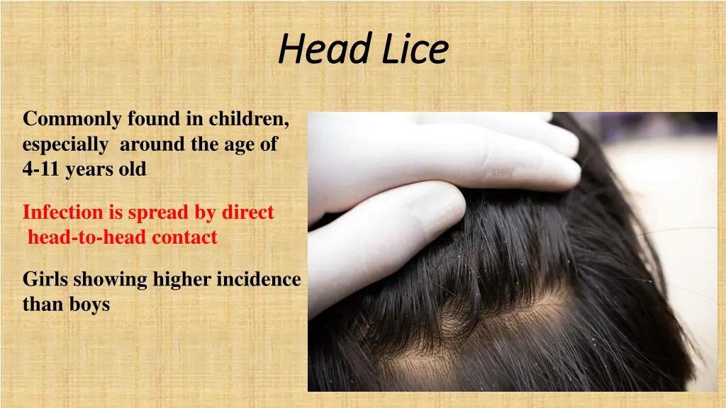 head lice head lice