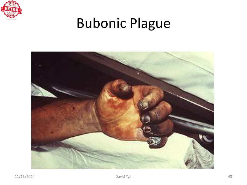 bubonic plague