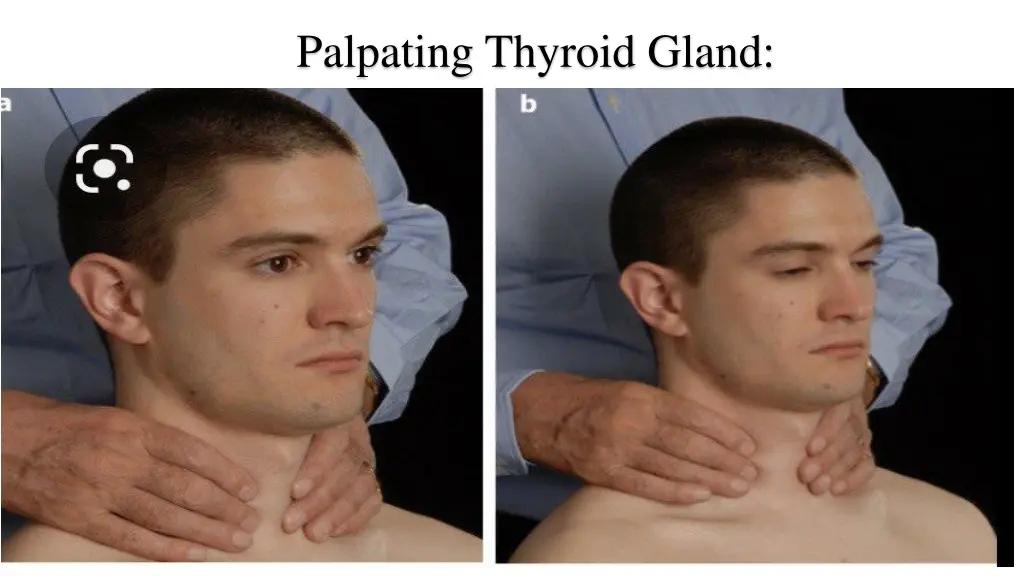 palpating thyroid gland