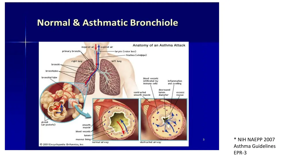 nih naepp 2007 asthma guidelines epr 3