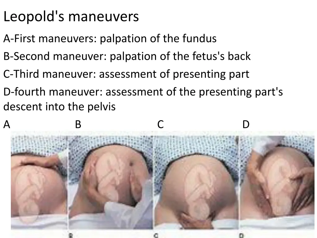 leopold s maneuvers