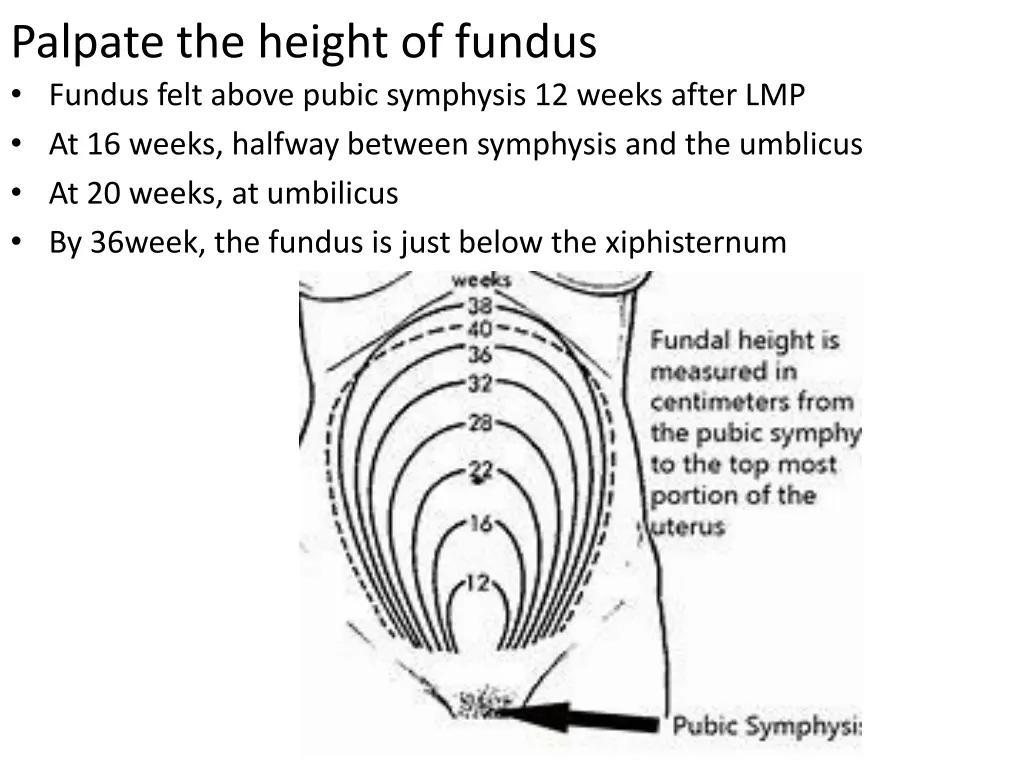 palpate the height of fundus fundus felt above