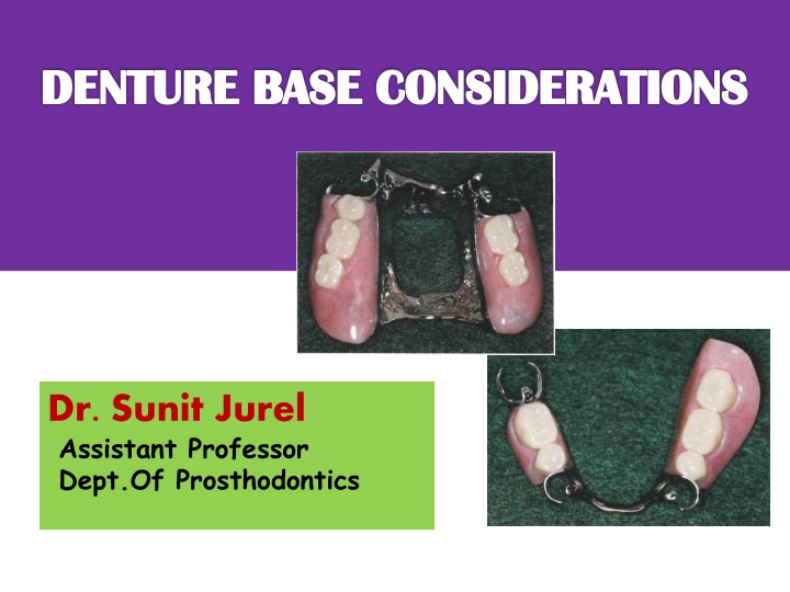 denture base considerations denture base