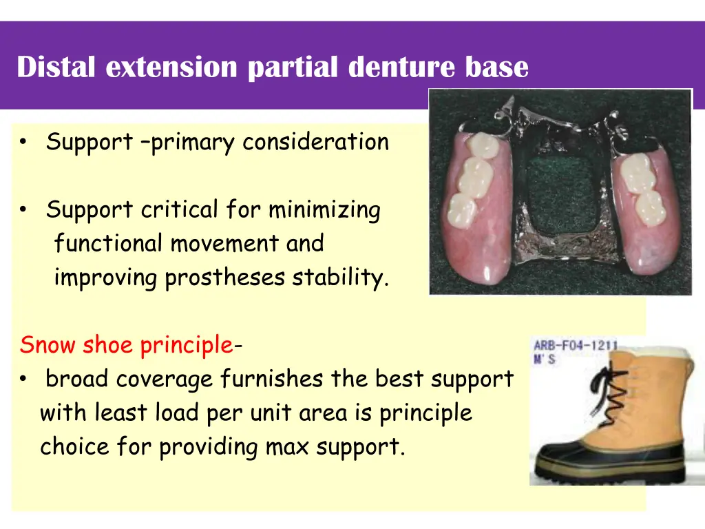 distal extension partial denture base