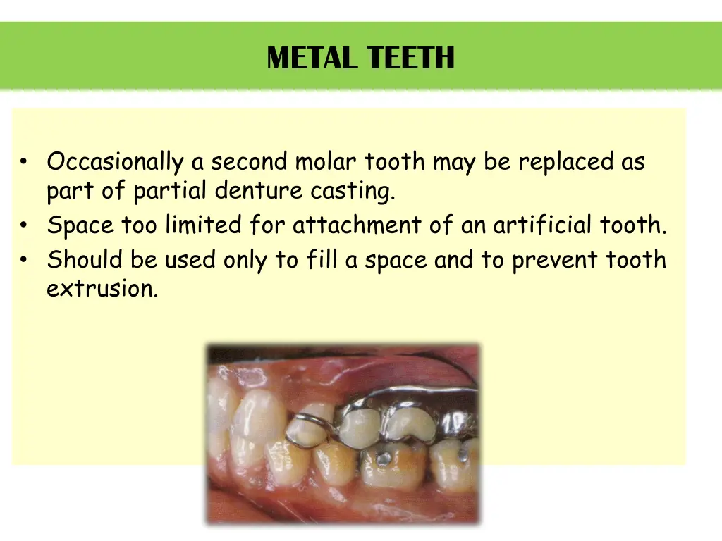 metal teeth