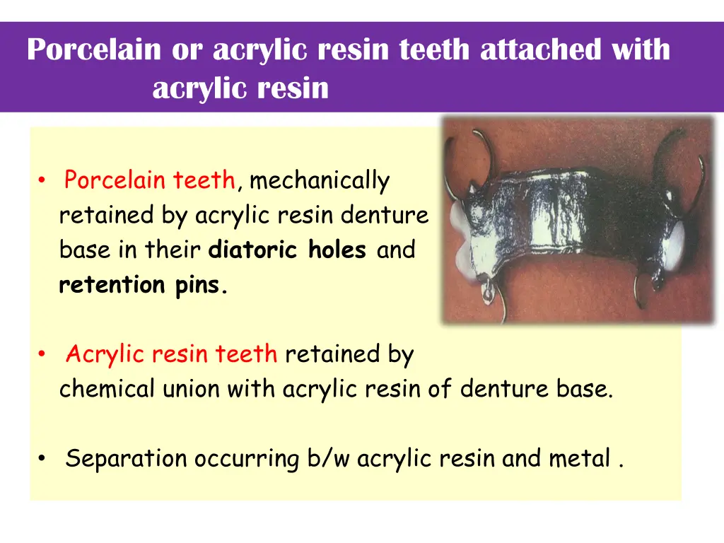 porcelain or acrylic resin teeth attached with