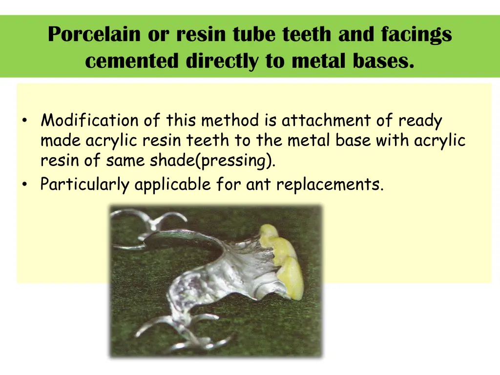 porcelain or resin tube teeth and facings