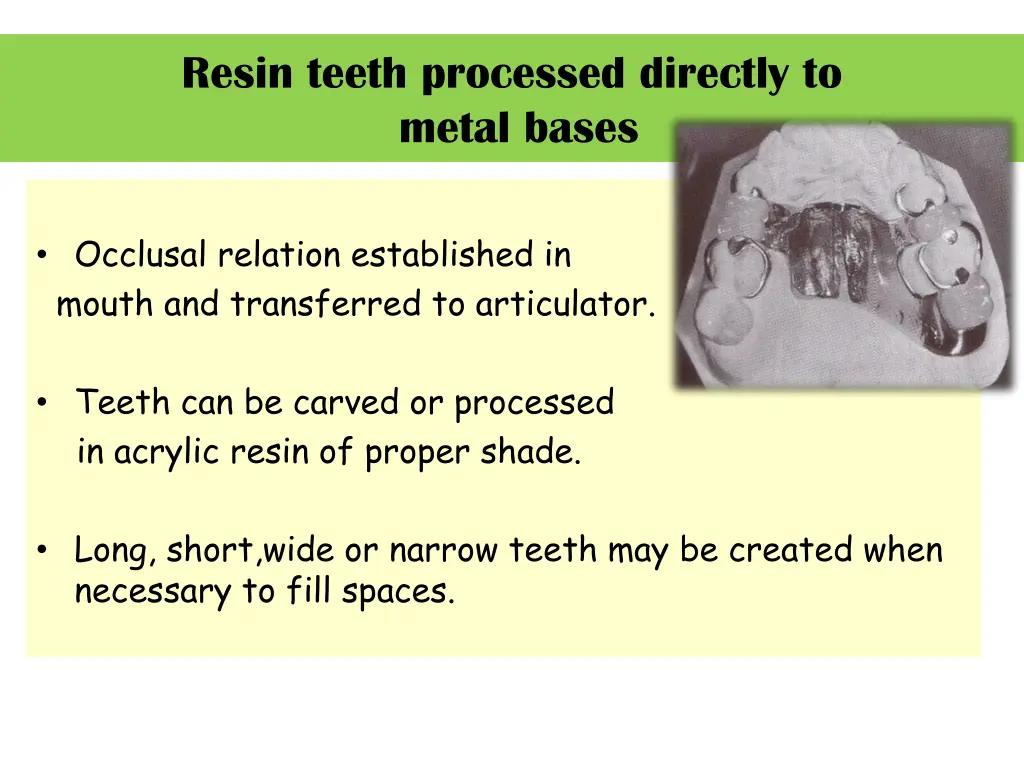 resin teeth processed directly to metal bases