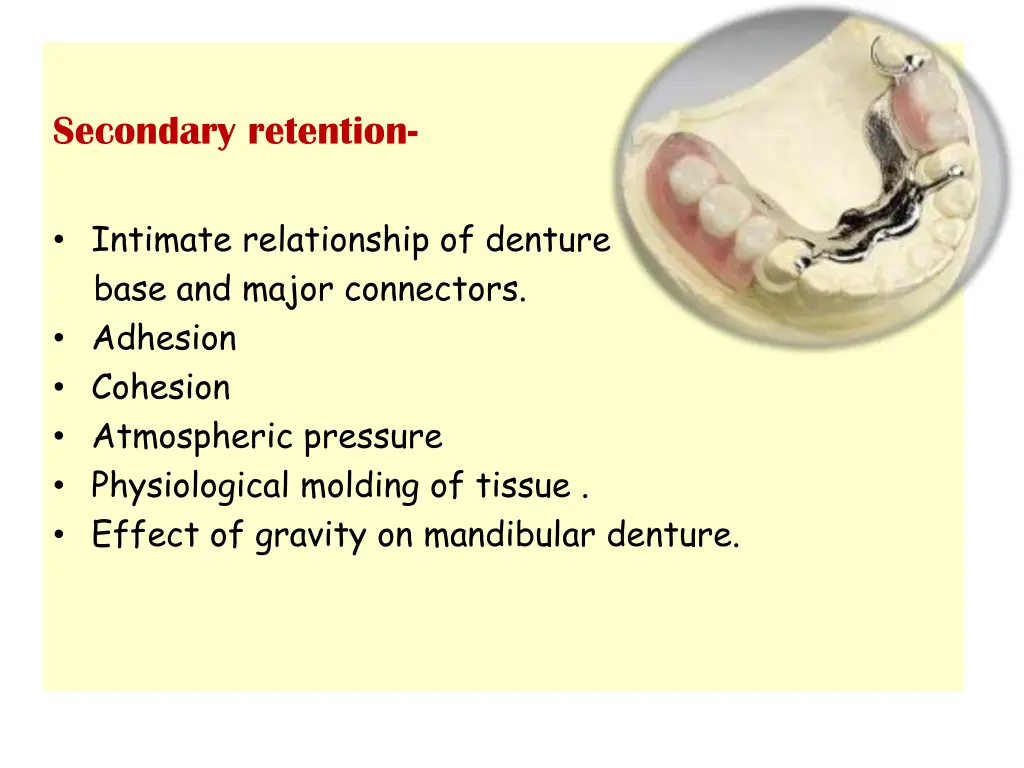 secondary retention