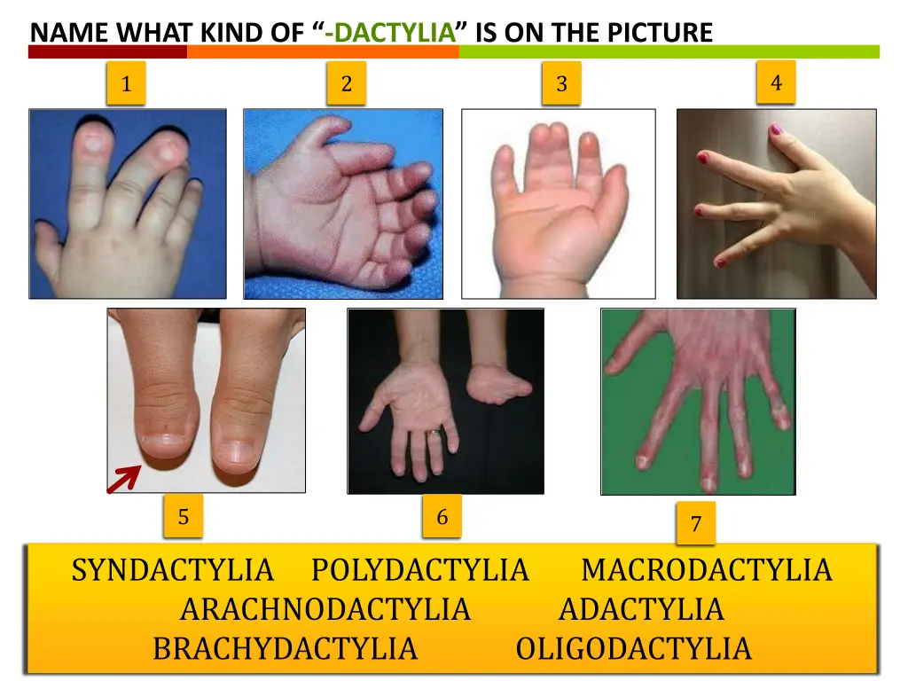 name what kind of dactylia is on the picture