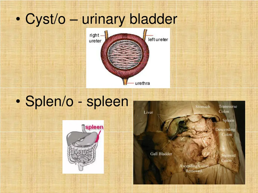 cyst o urinary bladder