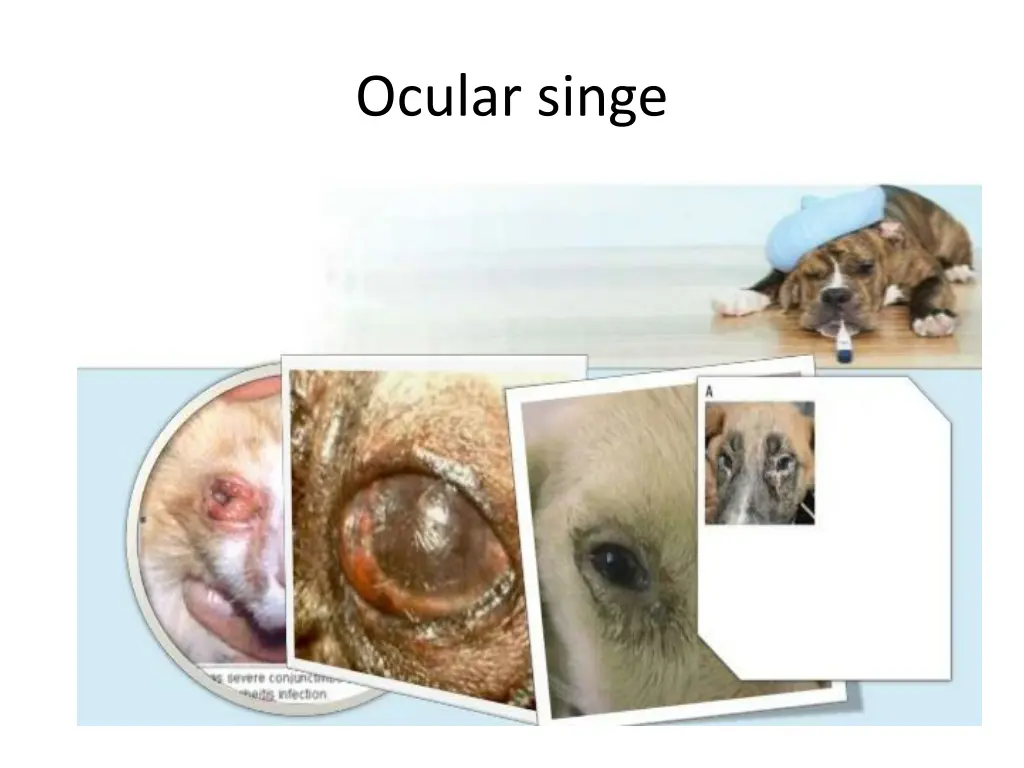 ocular singe