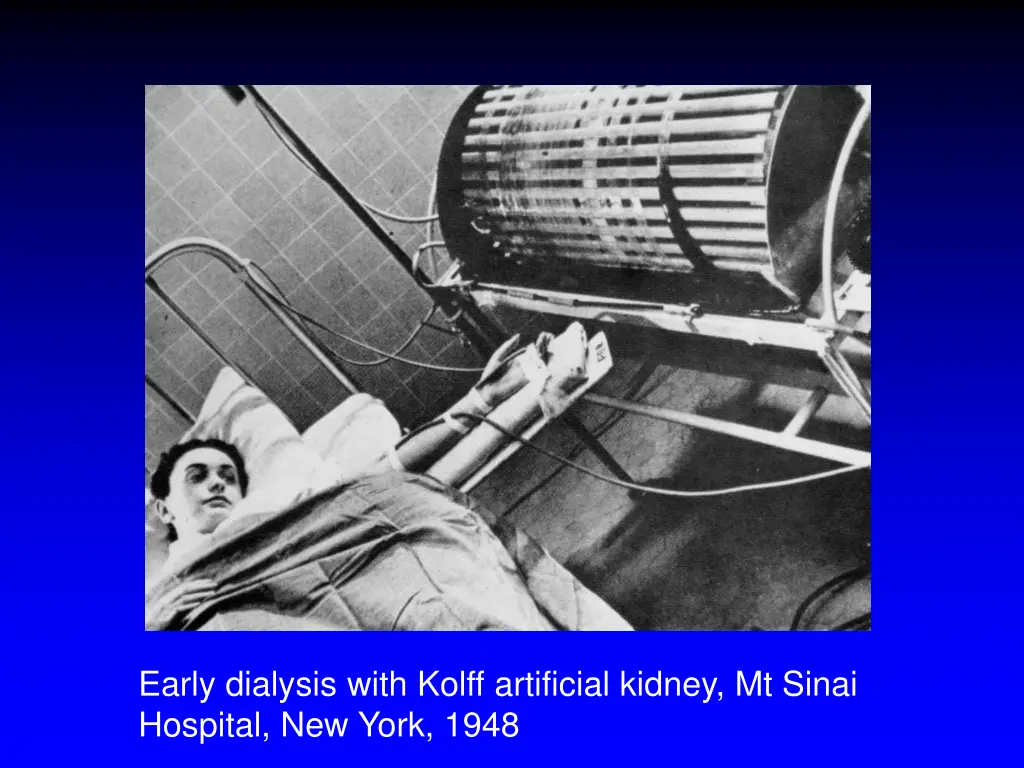 early dialysis with kolff artificial kidney