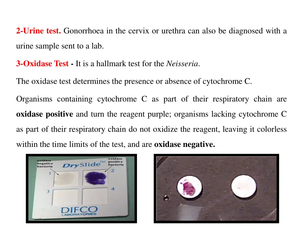 2 urine test gonorrhoea in the cervix or urethra